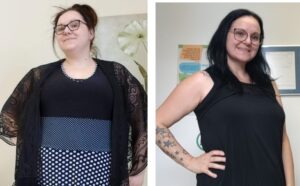 Christine Émond et la chirurgie bariatrique
