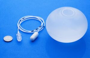 Technique du ballon gastrique