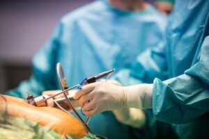 Chirurgie bariatrique et cancer du pancréas