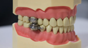 Dental Slim