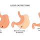 Est-ce que l'estomac repousse après une sleeve gastrectomie