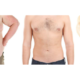 Adaptation à la Vie Après Chirurgie Bariatrique en Tunisie